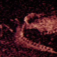 铁肺游戏手机版